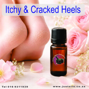 Ichy and cracked heals